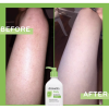 AMLACTIN Daily Moisturizing Lotion