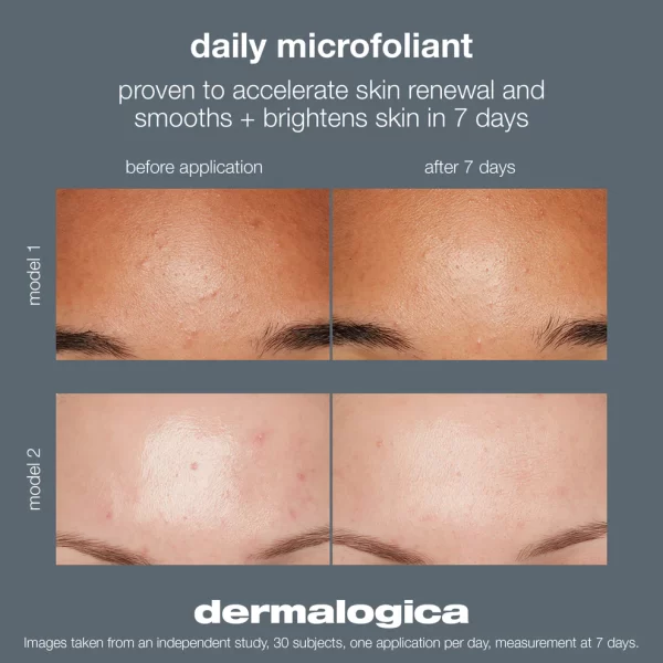 Dermalogica Daily Microfoliant - Image 2