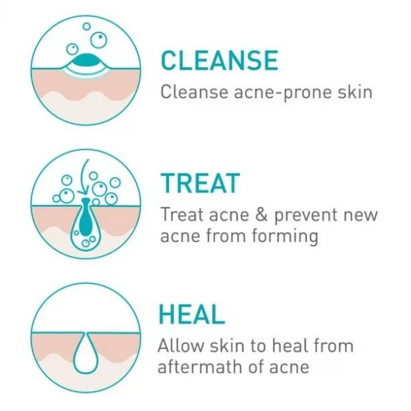 Cerave Acne Control Cleanser - Image 3