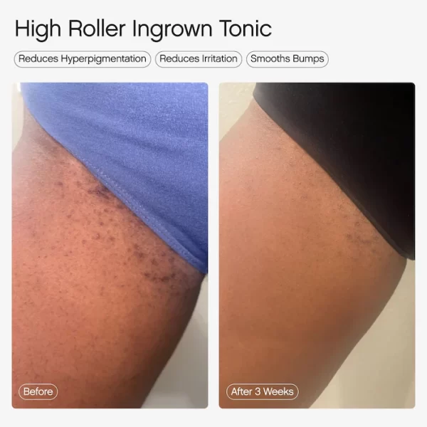 Topicals - High Roller Ingrown Hair Tonic with AHA and BHA - Image 3