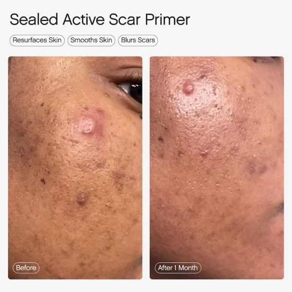 Topicals - Sealed Active Scar Filling Primer for Acne Prone Skin - Image 2