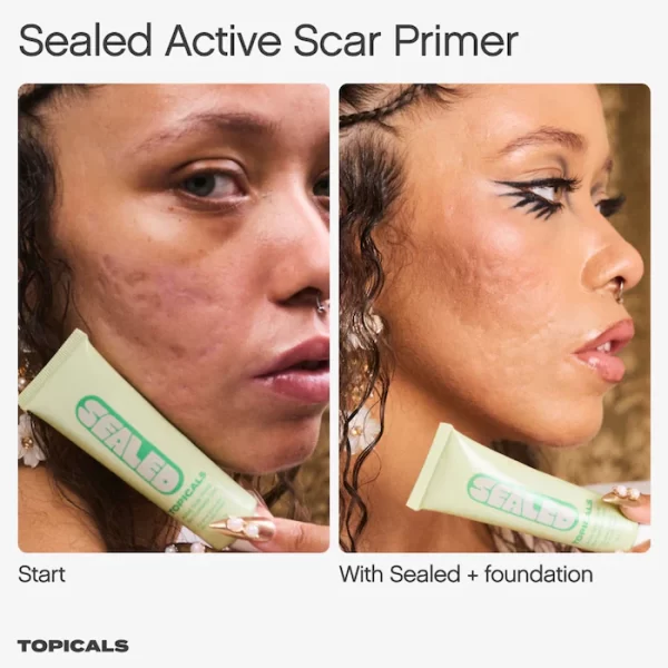 Topicals - Sealed Active Scar Filling Primer for Acne Prone Skin - Image 4